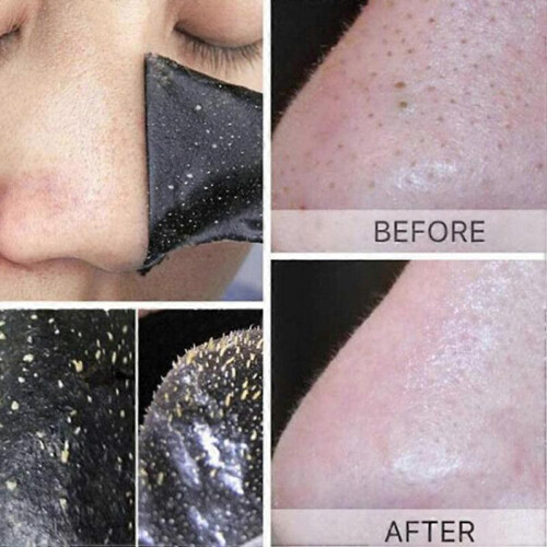 10 Pack Deep Cleansing Nose Strips Blackhead Removal 2