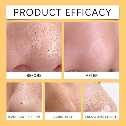 Pore Cleansing Patch - Remove Blackheads, Moisturize , Deep Clean Pores (10pcs) 2