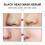 Blackhead Removal Strips for Nose, Deep Cleansing and Smooth Skin Solution 3