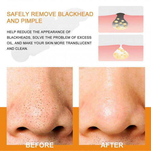 30pcs Hydrocolloid Nose Patch Herbal Extract Deep Cleansing Nasal Pore Strips for Blackhead Removal 2