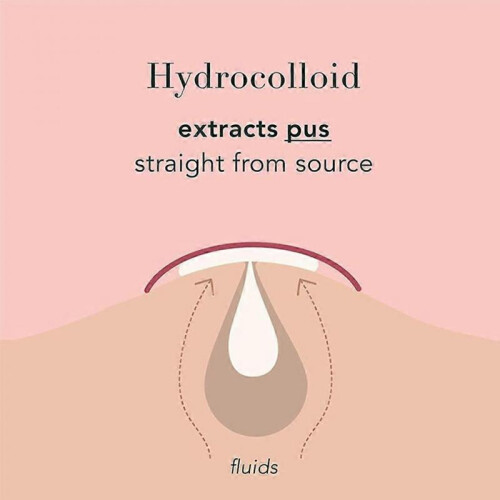 Dot for Spot Pimple Patches for Face Hydrocolloid Acne Patch Invisible Sticker 2