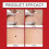 (1pack) "Micro Pimple Patch with Botanical Extract for Safe Skin Appendage Removal" 5