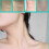Invisible Anti-Wrinkle Neck Correcting Strips for Instant Neck Lifting 2