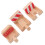 3Pcs Trilho Côncavo Reposição Expansão 7