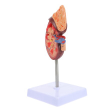 Human Kidney Anatomical Model For Biology Class