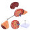 Human Kidney Anatomical Model For Biology Class 3