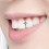 2 Pezzi Star Single Tooth Grills Per Hip Hop E Cosplay 5