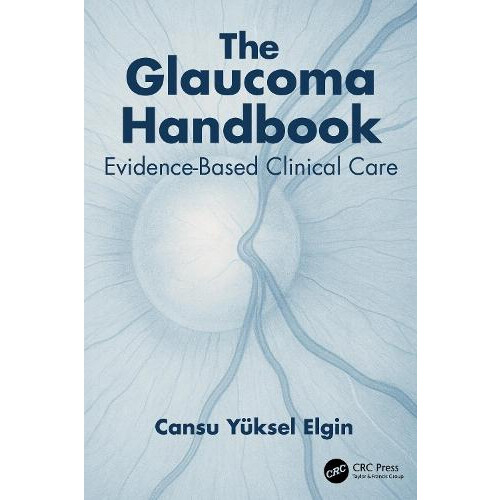 The Glaucoma Handbook by Cansu Yuksel Elgin Paperback Book