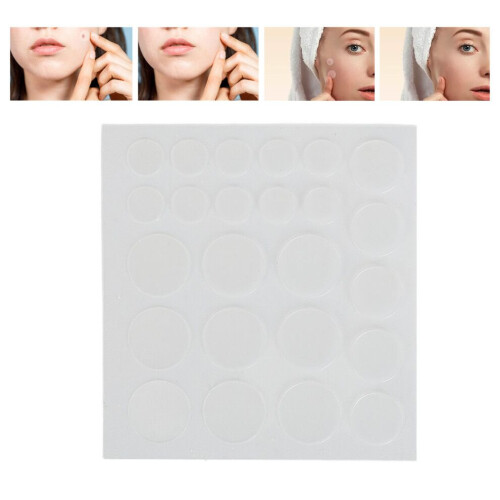 216Pcs Pimple Patches: Compact & Isolating Acne Treatment Solution