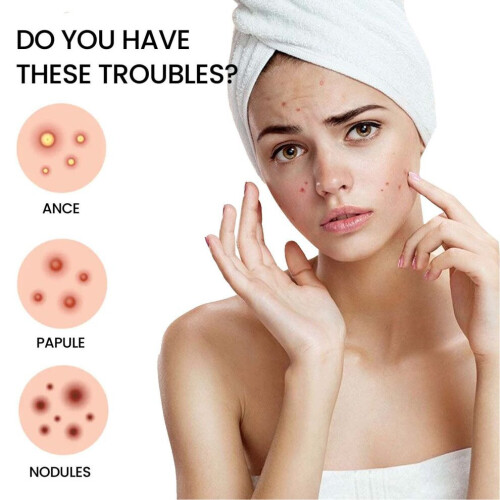 216Pcs Pimple Patches: Compact & Isolating Acne Treatment Solution 2