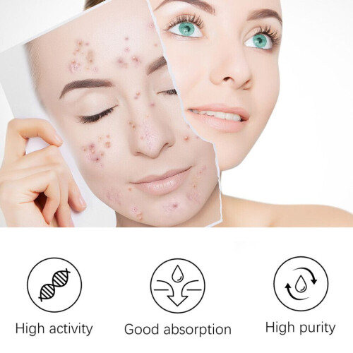 Large Hydrocolloid Pimple Patch for Face, Chin & Forehead, 3 pcs 2
