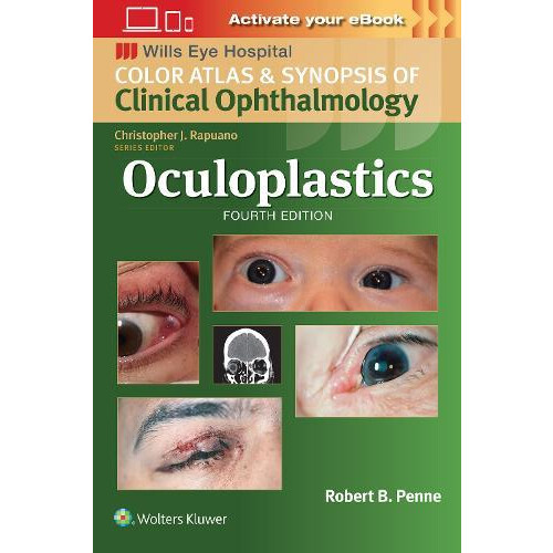 Oculoplastics by Robert Penne Paperback Book