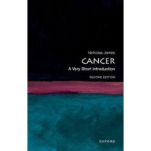 Cancer by James Nick Professor of Prostate and Bladder Cancer Research