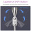 340 Degree Strong Magnetic Sorption for Assist- explosionproof 6