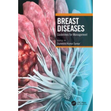 Breast Diseases Paperback Book