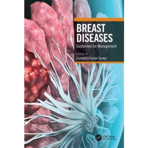 Breast Diseases Paperback Book