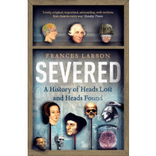 Severed by Dr Frances Larson Paperback Book