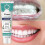 (2pcs)Hydroxyapatite fluoride free toothpaste, whitening toothpaste, fresh breath anti-decay toothpaste, reduce tooth stains whitening toothpaste 2
