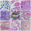 Microscope Slides with Specimens From Children, Mi 6