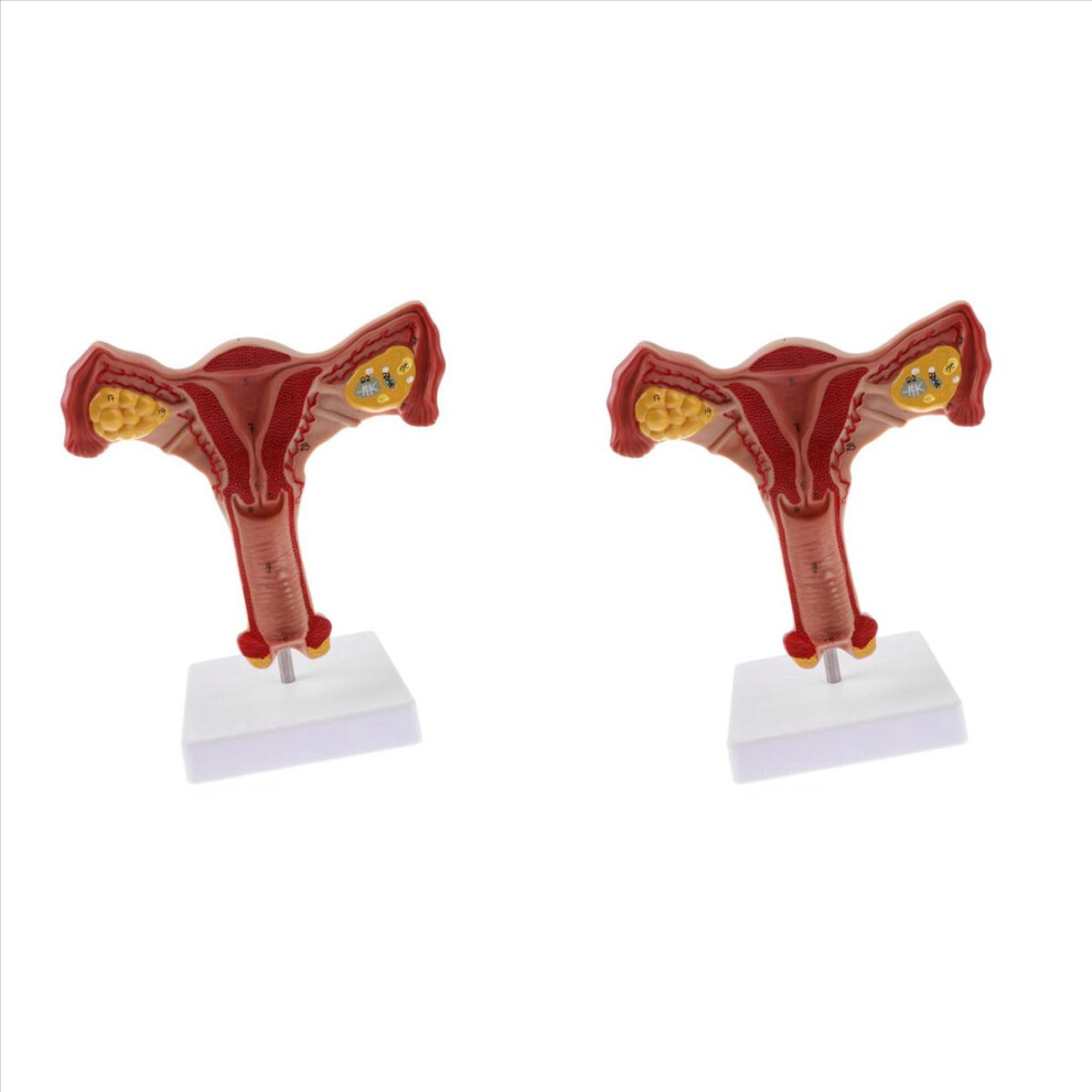 Jojomino 1:1 Human Female Uterus Ovary Fallopian Tubes Model Teaching Tools