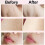 USB Charging Epilator Bikini Armpit Arm Electric H 5