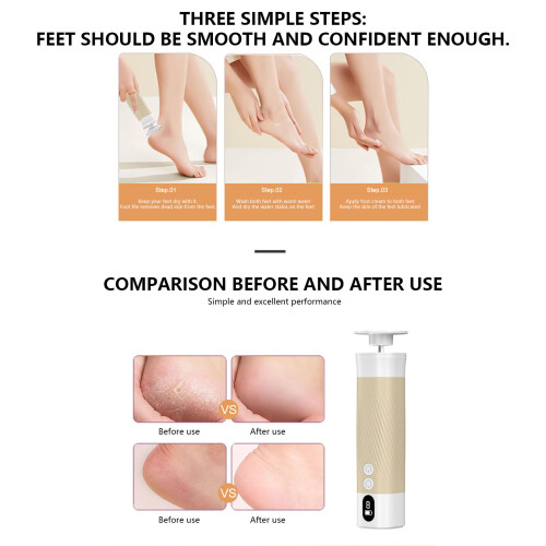 Advanced Foot Skin Reawakening Tool 9 Stage Tailoring Auto 1
