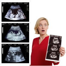 Ecografia Finta Gravidanza per Coppie – Foto Sonogramma Personalizzata Divertente, Regalo Scherzo Realistico per Partner