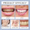 Tooth Stain Remover - Tea Stain, Brighten Teeth 14