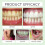 Dental Adhesive Gentle Fresh Enamel 13