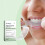 Dental Adhesive Gentle Fresh Enamel 2