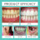 Denture Strips for Removing Tea & Coffee Stains, Brightening Teeth 13