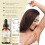 Mild Hair Removal Essential Oil 3
