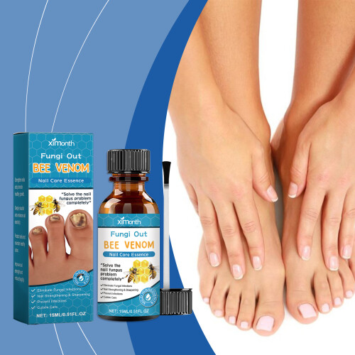 Bee Venom Nail Solution for Grey Toenails & Thickening 1