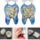 1 Box Dental Temporary Crown Veneer Porcelain Teeth Front Back Molar Teeth 3