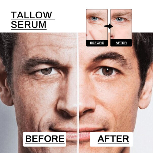 Anti-Falten straffendes Serum für Männer 2