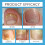 Zehennagelpflegecreme - Mild & Reparierend 11