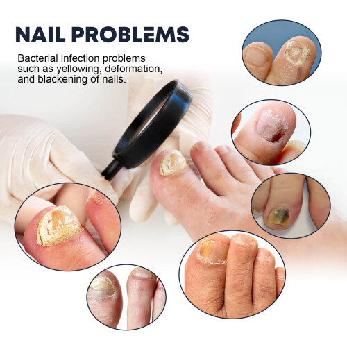 Nail Strengthening & Moisturizing Spray for Brittle Nails 2