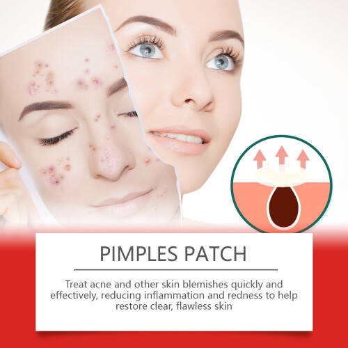 Morning Evening Acne Covering Patch Skin Relief 2