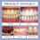 Portable Enamel Repair Solution 11