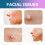 Cute Color Acne Patch Lighten Pimples Breathable 3
