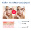 3-in-1 Acne Gel: Deep Cleanse, Fade Marks, Moisturize 12