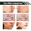 3-in-1 Acne Gel: Deep Cleanse, Fade Marks, Moisturize 15