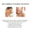 3-in-1 Acne Gel: Deep Cleanse, Fade Marks, Moisturize 10