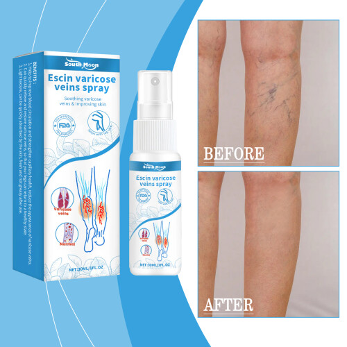 Leg Treatment Spray for External Moisturizing & Repair 1