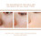Peeling-Gel für empfindliche Haut, Entfernung von Mitessern 11