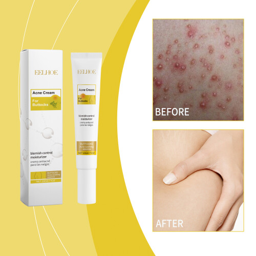 Po-Pflegecreme: Feuchtigkeitscreme & Massageöl 1