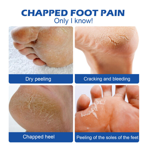 Hand and Foot Moisturizing Cream 2