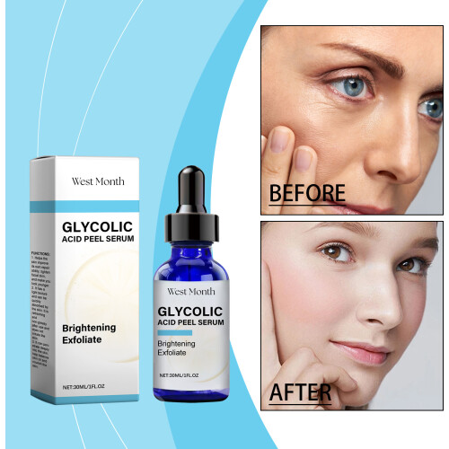 West Month Vitamin C Essence for Moisturizing & Brightening 1