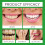 Tooth Cleaning Mousse Reduces Stains Fresh Foam 15