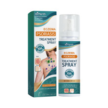 Ekzem-Psoriasis-Spray zur Linderung von Juckreiz und Rötung